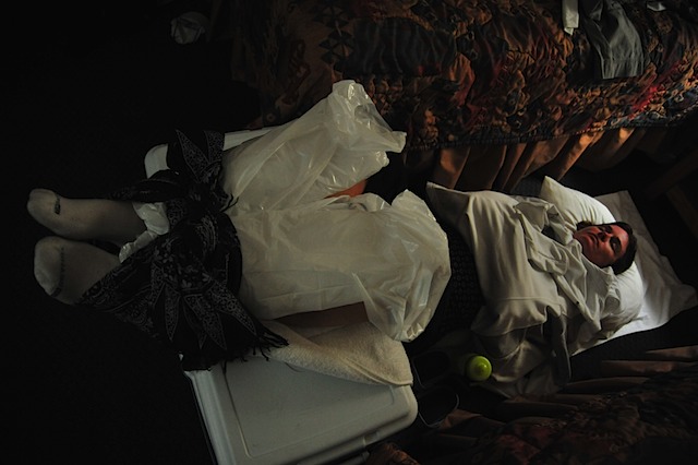 Post euphoria: icing the legs.